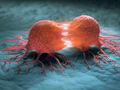 2 سرطان شایع بانوان قابل پیشگیری است