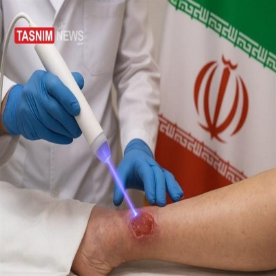 پلاسمای سرد؛ کاربرد انسانی و صلح‌آمیز صنعت هسته‌ای ایران