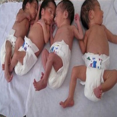 822 خانواده دارای فرزند چندقلو از بهزیستی همدان خدمات دریافت می‌کنند