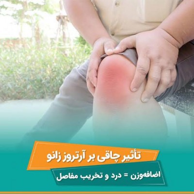 چاقی و فشار مداوم؛ قاتلان خاموش غضروف زانو